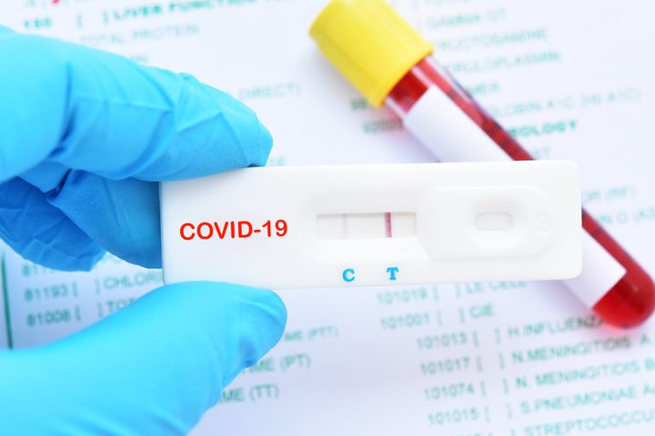 Test IgM e IgG coronavirus